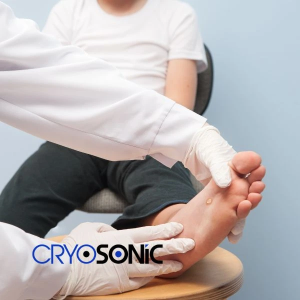 Are you looking for fast effective wart removal Contact us today Tavistock